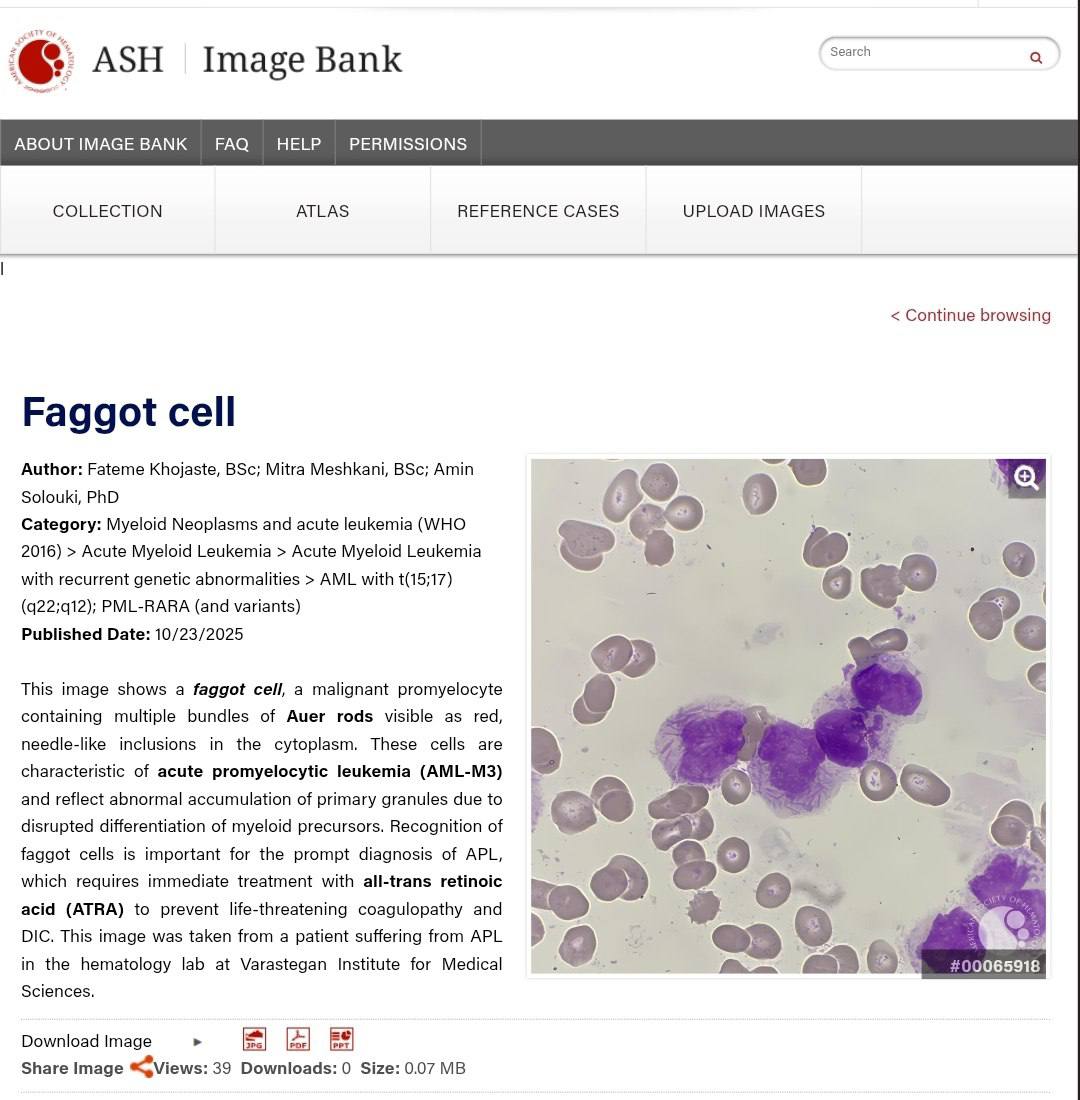 چاپ عکس در اطلس هماتولوژی انجمن هماتولوژی آمریکا (ASH